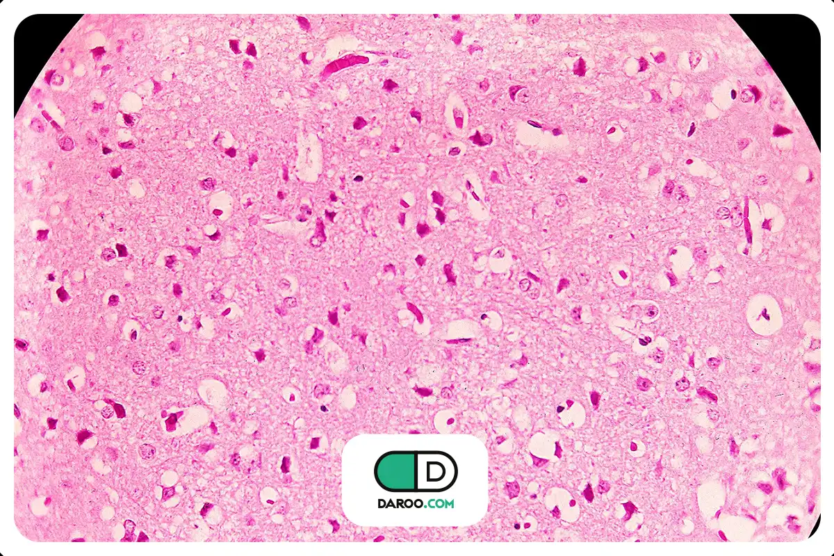 ویروس ونزوئلایی