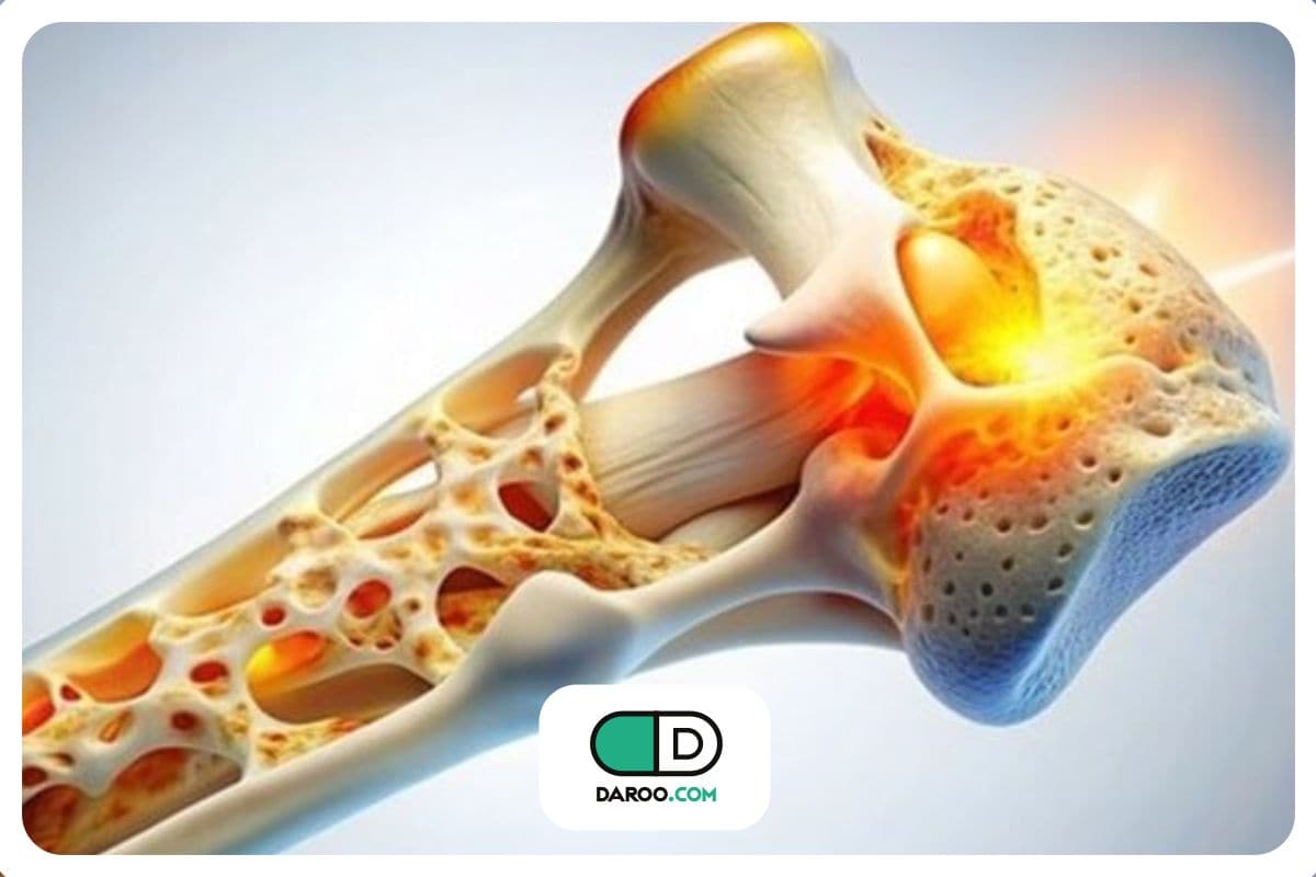 این خوراکیها، برای سلامت استخوان شما خطرناکند