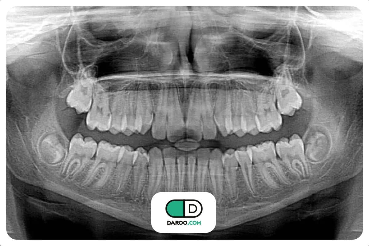کمترین اشعه، بیشترین دقت؛ دستورالعمل جدید رادیوگرافی دندانپزشکی